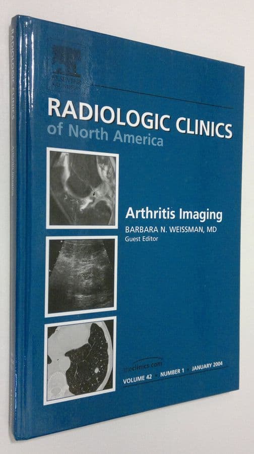 Barbara N. Weissman : Arthritis Imaging : Radiological Clinics of North America - january 2004, vol. 42 nr. 1